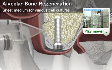 Alveolar Bone Regeneration